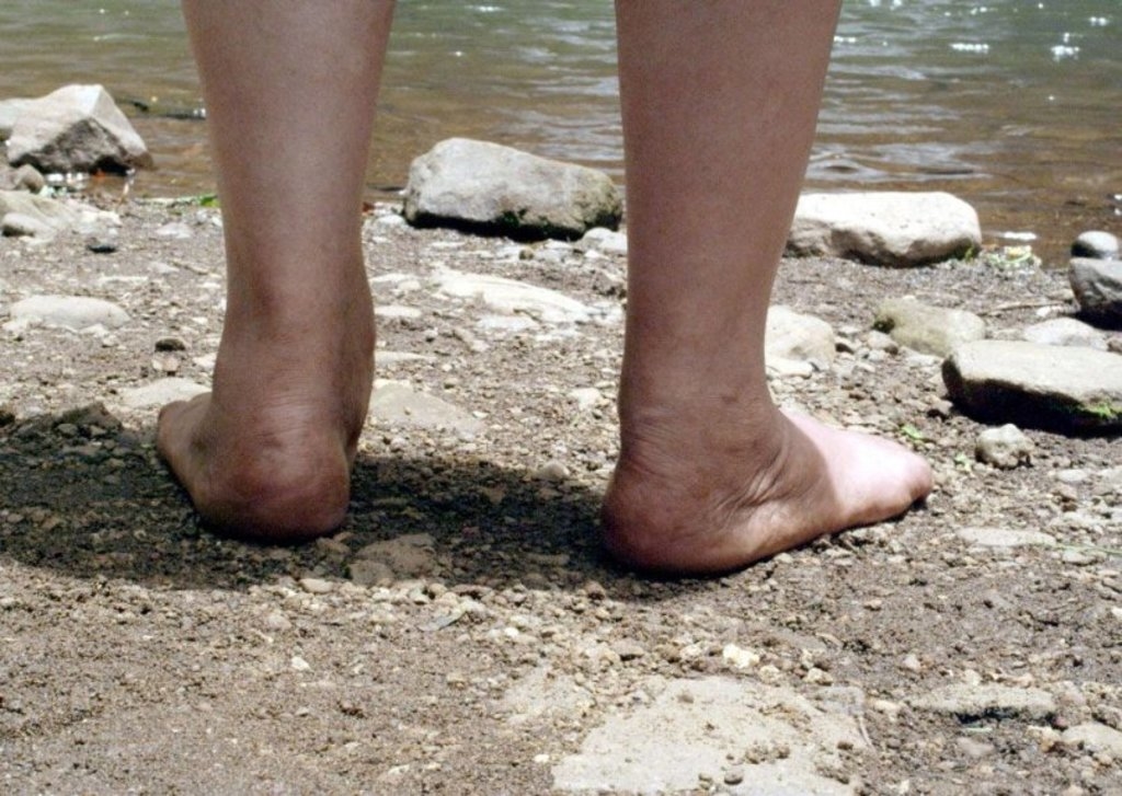 Write caption for image (optional)